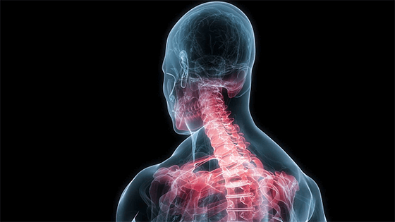 Neck pain, xray outline